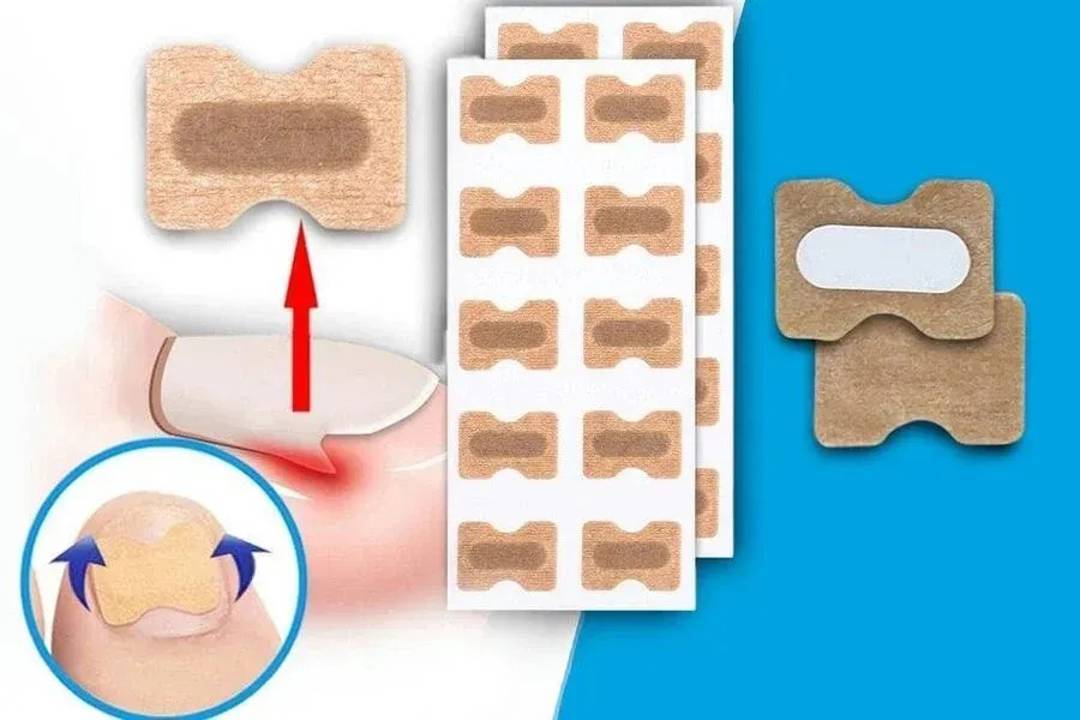 Pflaster gegen eingewachsene Nägel, 50 Stück